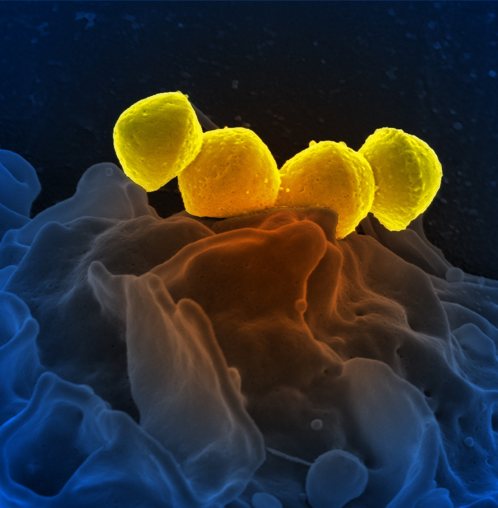 bacteria photo